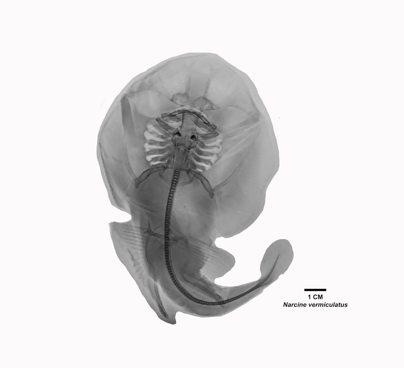 Radiografía especie